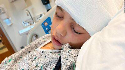 Injured Little Leaguer Easton Oliverson out of surgery, doctors 'happy' with outcome