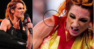 Becky Lynch - Bianca Belair - Becky Lynch injury: Gruesome image of separated shoulder sustained at WWE SummerSlam - givemesport.com