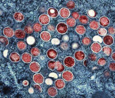 Indiana University Health begins monkeypox testing at lab