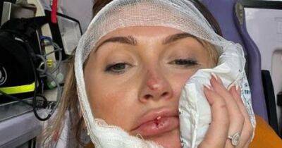 Charlotte Dawson in horror accident in Rome as she reassures fans "I'm OK"