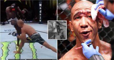 UFC's worst injuries: Gregory Rodrigues' gruesome cut is hard to look at - givemesport.com