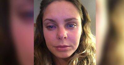 Personal trainer, 24, left partially-blind after contact lens blunder - manchestereveningnews.co.uk - Australia