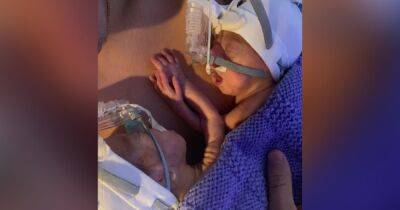 I was at a party when my waters broke... then I was told I'd have to say goodbye to one twin - manchestereveningnews.co.uk - Manchester