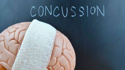 Concussion study finds link to worsened brain function - rte.ie - Britain -  Oxford