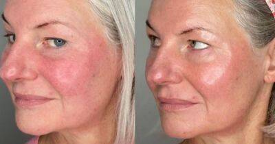 Beauty fans say 'magic' £10 Boots anti-ageing serum works SO fast it's a 'beauty sleep in a bottle' - manchestereveningnews.co.uk - county Day