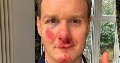 Dan Walker - Presenter Dan Walker ‘confident’ he is not to blame following bike crash - manchestereveningnews.co.uk -  Sheffield - county Oldham