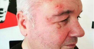 Stacey Solomon - Eamonn Holmes 'nearly went blind' after health scare brought on by £250k tax bill - manchestereveningnews.co.uk - Jordan