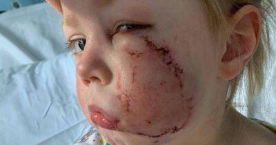 Girl, 4, has 40 stitches after American Bulldog mauls her face