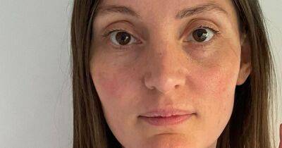 'Ten days in a basement in Ukraine aged me many years - dermal fillers have helped me start again' - manchestereveningnews.co.uk - Britain - Russia - Ukraine