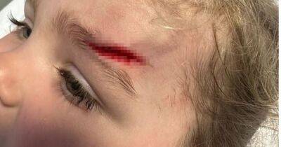 Little girl, 3, left with 'sliced' head after going 'flying' when bus driver slammed brakes