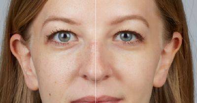 'Boots £10 anti-wrinkle cream gives such drastic results, every woman over 30 should try it'