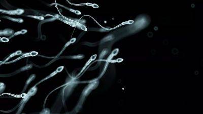 Sperm counts are declining globally. Scientists believe they have pinpointed the main causes why
