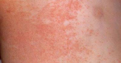 Beauty buffs hail £7 Amazon cream a Summer 'must' for anybody who gets shaving or heat rash - manchestereveningnews.co.uk