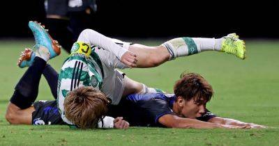 Kyogo dealt major Celtic injury blow as Brendan Rodgers reveals striker will undergo shoulder surgery