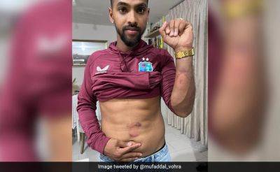 Brandon King - Nicholas Pooran - Arshdeep Singh - Nicholas Pooran, Hit By Arshdeep Singh's Delivery And West Indies Teammate's Shot, Shows Off Bruises - sports.ndtv.com - New York - India - Guyana