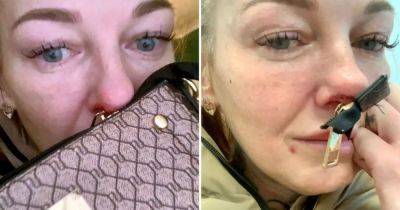 Beauty salon owner left in tears after getting handbag zip stuck through her nose in 'freak accident'