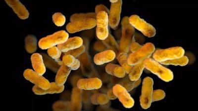 Whooping cough cases surge in US, Europe post-COVID pandemic - euronews.com - France - Usa