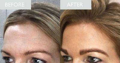 'After one application I noticed a huge difference': Award-winning retinol beauty buffs 'swear by' for forehead lines