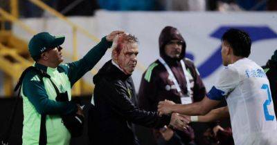 Javier Aguirre - Luis Palma - Luis Palma goes clutch for Honduras before Celtic star sees things turn nasty with Mexico manager left covered in BLOOD - dailyrecord.co.uk - Scotland - Mexico - Honduras