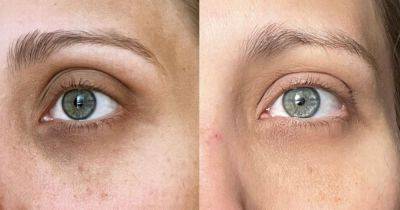 Beauty buffs 'floored' by before and after results from sagging eye cream now 40% off for Black Friday