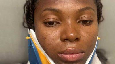 Brume narrates car crash experience, gets NSC’s $30,000