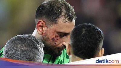 Gianluigi Donnarumma - Paris Saint-Germain - Monaco Vs PSG: Donnarumma Dapat 10 Jahitan di Wajah - sport.detik.com - Monaco