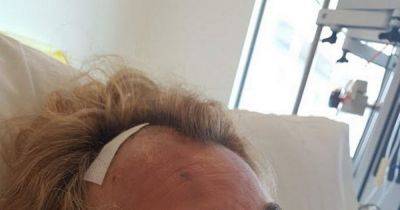 Woman who suffered brain haemorrhage makes 'common sense' plea to bus drivers