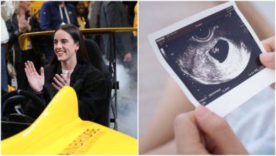 Someone Had Caitlin Clark Sign An Ultrasound Photo At Pacers Game