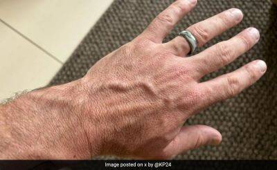 Kevin Pietersen - England Cricket Great Removes Watch, Wears Plastic Ring Before Going To London, After Calling It "Disgrace" - sports.ndtv.com
