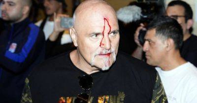 Tyson Fury’s father John suffers cut to head as Oleksandr Usyk fight week begins