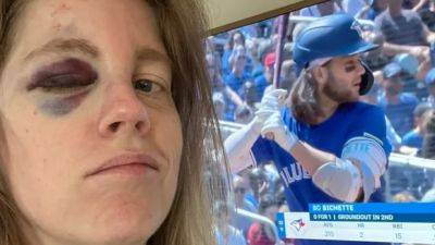 Fan beaned at Jays game to get ball signed by Bo Bichette