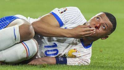 Dider Deschamps fears Kylian Mbappe's nose was broken in Austria win