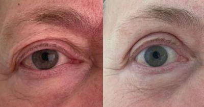 'I wanted to try the 37p solution that claims to instantly lift sagging eyelids - but my mum stole it' - manchestereveningnews.co.uk