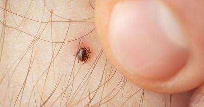 'Vampire bugs' hit Britain's beaches - as bite risks being crippled or blinded - manchestereveningnews.co.uk - Britain - Russia