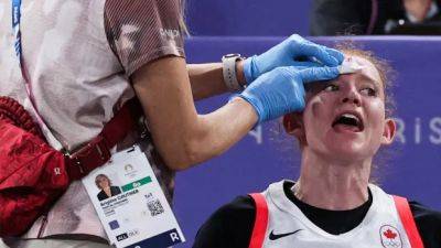 Canada's 3x3 basketball women will remember hard-fought journey more than Olympic medal miss