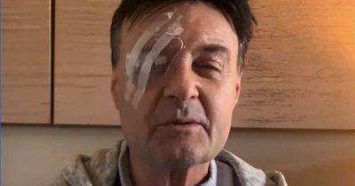 West End star blinded in horror road rage as thug 'punches' through car window - manchestereveningnews.co.uk - Instagram