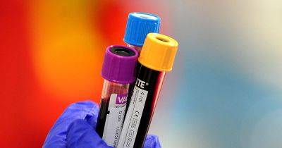 Breakthrough test with 90 per cent accuracy could help 500,000 people in UK at high risk of cancer - manchestereveningnews.co.uk - Britain