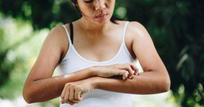 Why scratching that itch can give health benefits - but also be bad for you - manchestereveningnews.co.uk - Washington - state Indiana - state Missouri - county St. Louis