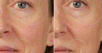 Beauty buffs 'ditch Botox' for new serum that makes wrinkles 'immediately less visible'