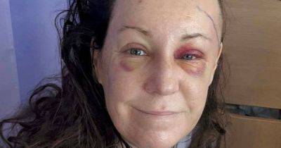 Woman gets devastating diagnosis after routine eye test - manchestereveningnews.co.uk - county Oxford