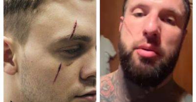Russian men are paying tattoo artists for facial scars 'to look more masculine' - manchestereveningnews.co.uk - Russia