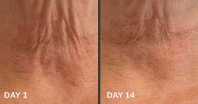 Marks and Spencer shoppers floored by rapid change in skin after applying 'crepey neck' cream