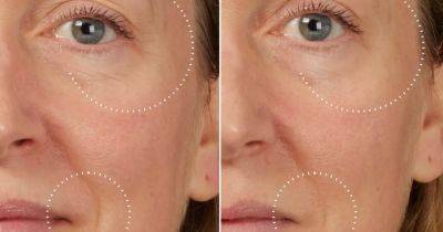 The bestselling 'liquid Botox' serum that promises to reduce wrinkles in just 10 minutes