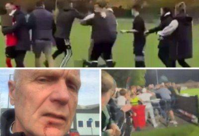 Kent football: Violent incidents at matches between players, referees and spectators on the rise - kentonline.co.uk - county Kent