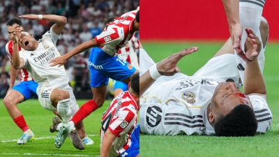 That's Gotta Hurt! Real Madrid's Kylian Mbappé Left With Bloody Gash - foxnews.com - France